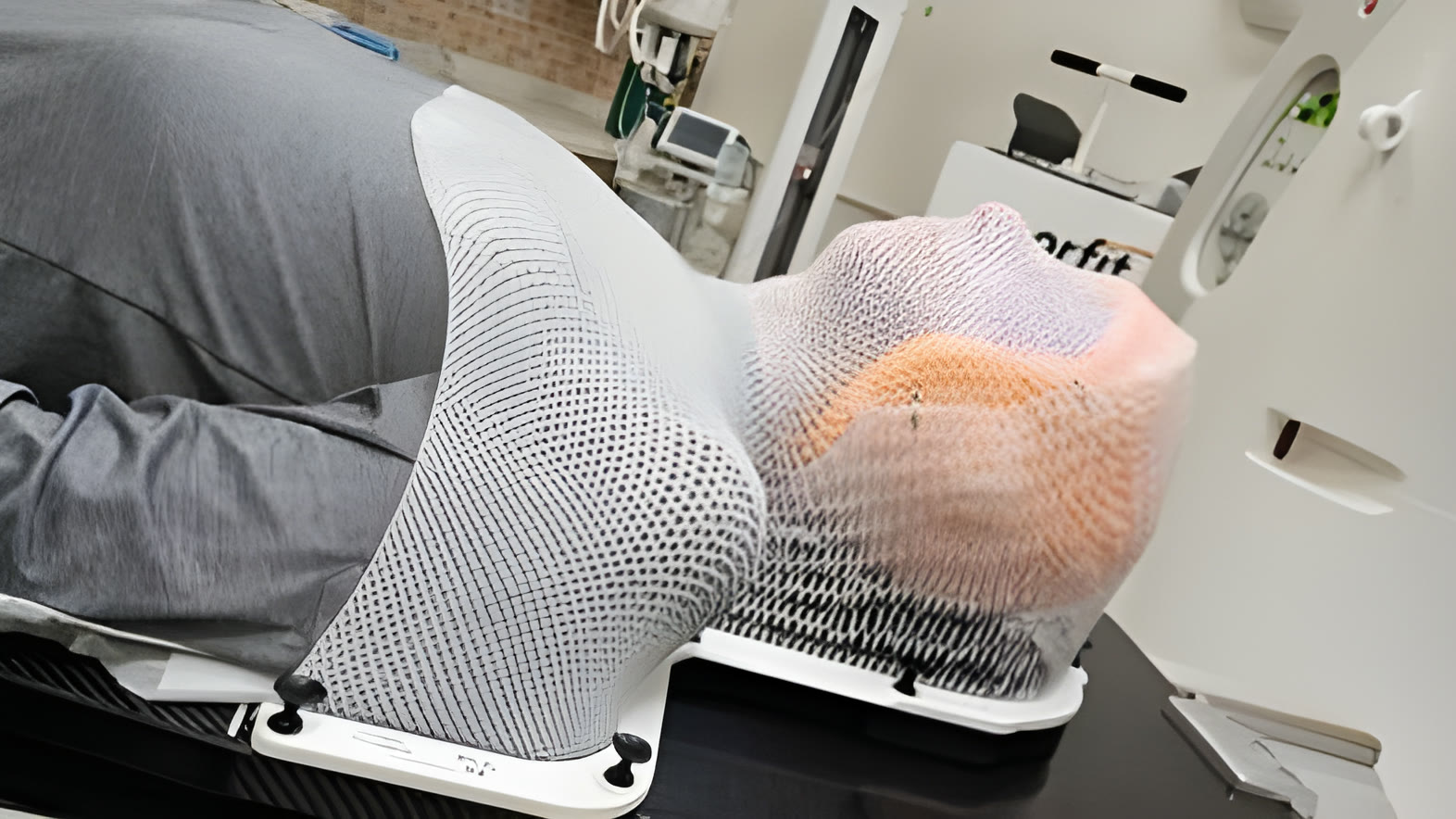 Patient wearing a custom 3D-printed radiotherapy immobilization mask